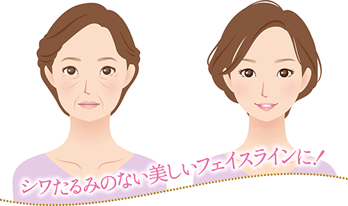シワたるみのない美しいフェイスラインに！